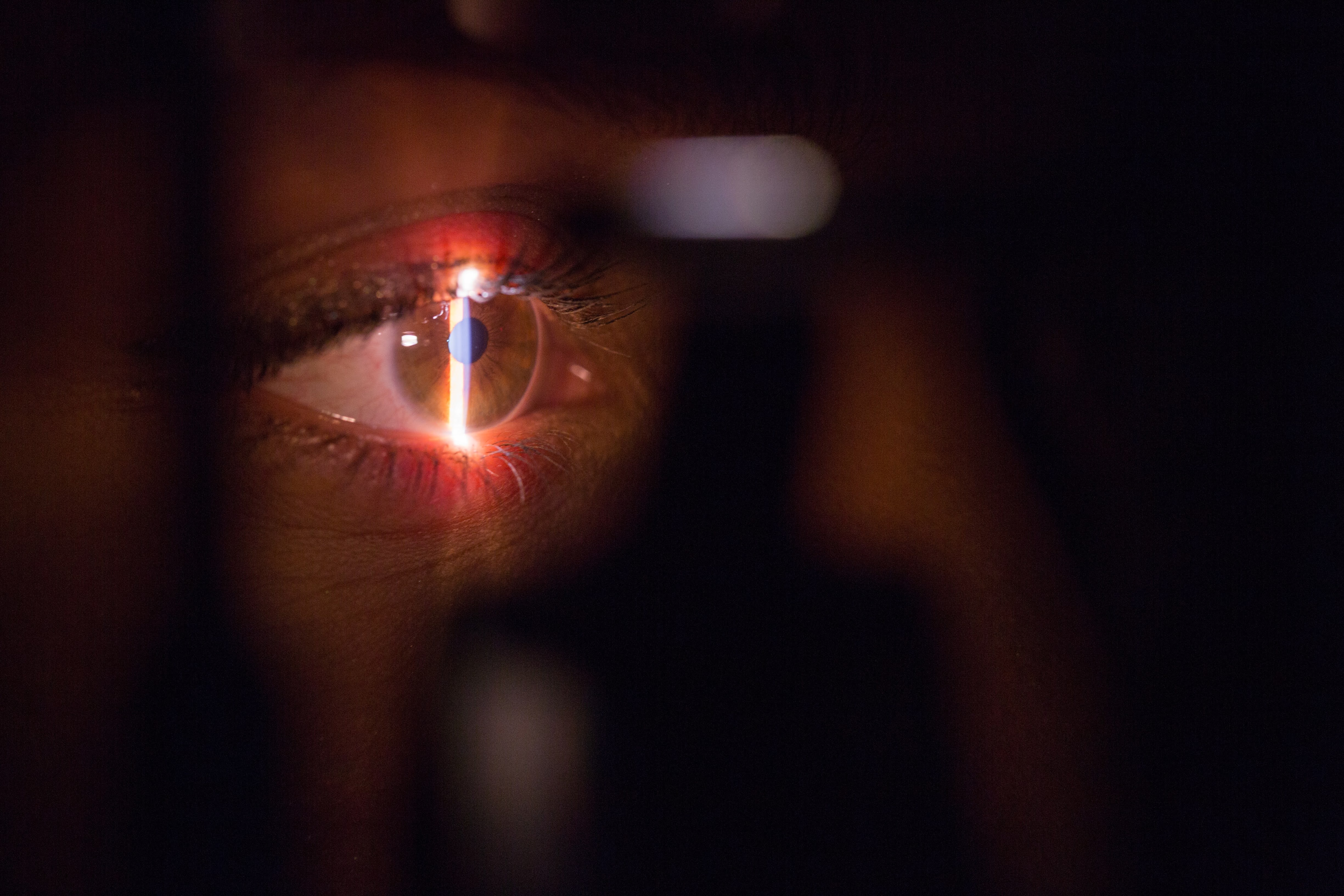 Do you know the five warning signs of glaucoma?